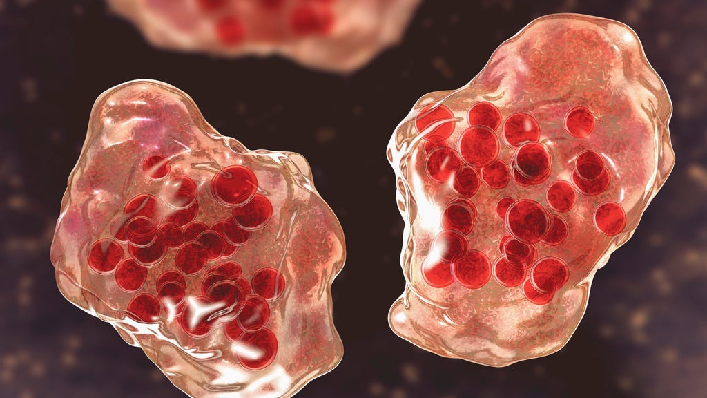 Central Minnesota county reports "several cases of suspected measles" — WCCO / CBS Minnesota, Maplewood Health news