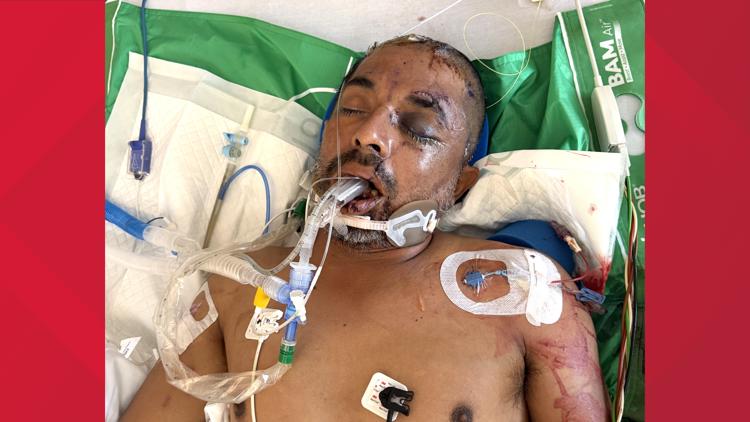 University Hospital asks for help identifying unconscious patient hit by truck Saturday evening — KENS 5 (San Antonio), Maplewood Health news